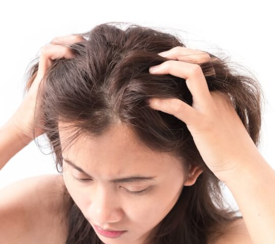 What Are Scalp Bumps? Safe and Effective Treatments for Those Bumps on Your Head